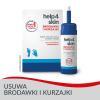 Help4Skin brodawki i kurzajki aerozol do wymrażania, 50 ml